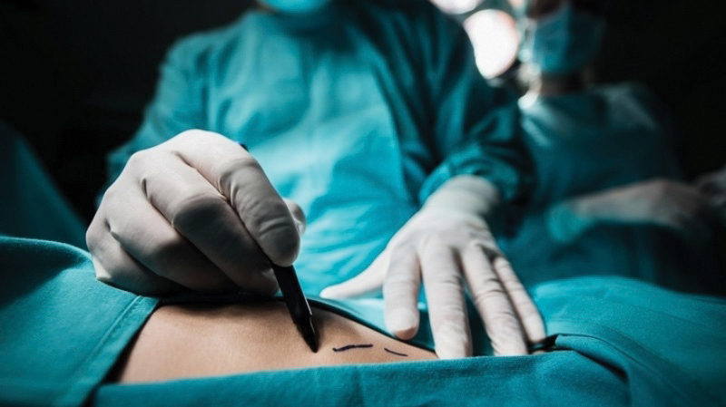 ¡Insólito! Cirujano grabó sus iniciales en los hígados de sus pacientes