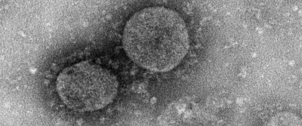 ¿Cuánto dura el coronavirus vivo en superficies y cómo protegerse?